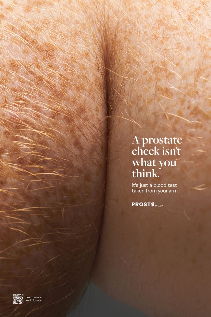 The Other Prostate Check