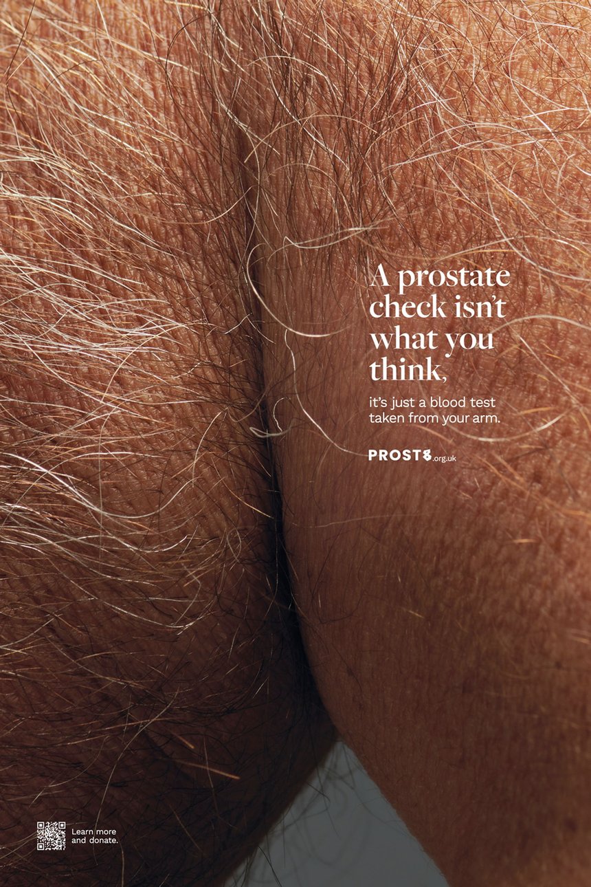 The Other Prostate Check