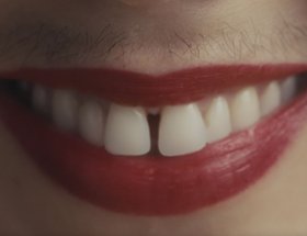 Amazon Prime - Tache